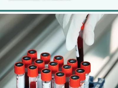 Serviço de Análises Laboratoriais : Segundo Par de Olhos no Diagnóstico