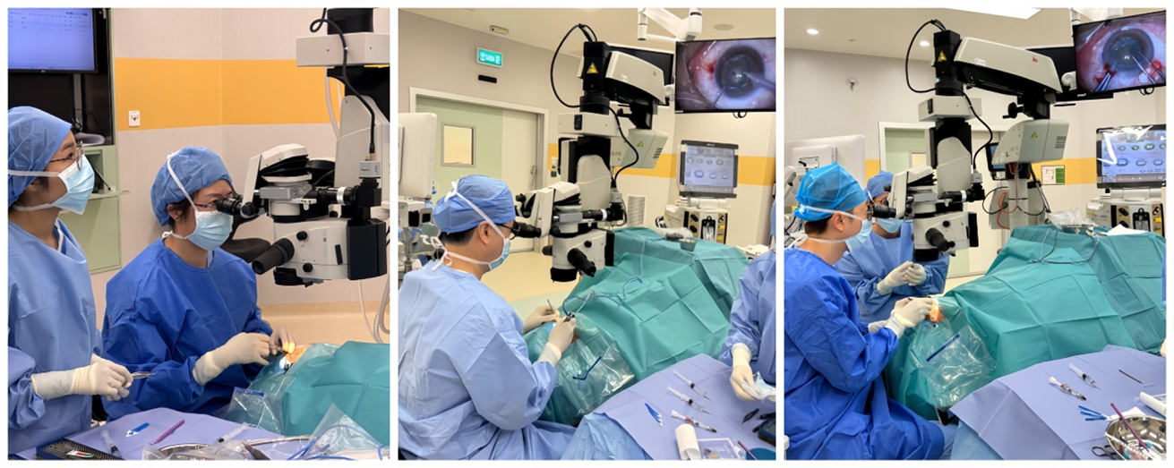 Ophthalmology Department of Macao Union Medical Center launches routine ambulatory cataract surgery